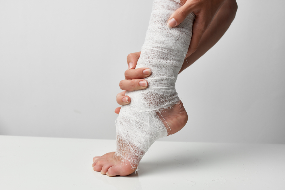 Verstauchter Fuß vs. Gebrochener Fuß: Wie kann man diese beiden unterscheiden?